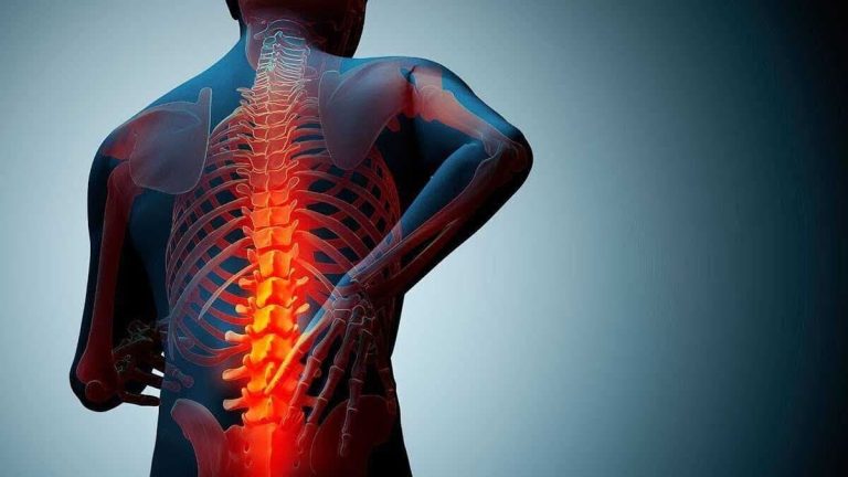 متدولوژی پوکی استخوان چیست ؟