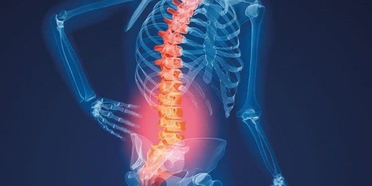 فیزیوتراپی و تمرینات توان‌بخشی برای بهبود درد و عملکرد ستون فق