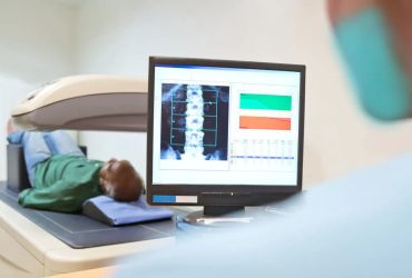 گزارش BMD به روش DXA و نکات مهم در ارزیابی و تحلیل آن